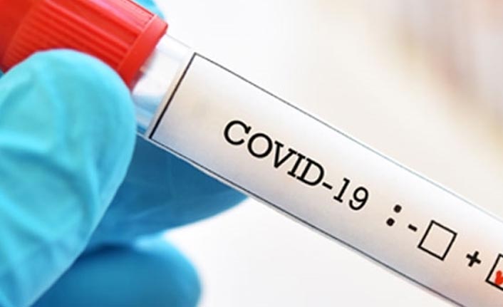 13 yaşındaki çocuk koronavirüs nedeniyle öldü 31 Mart 2020