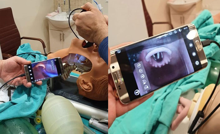 Yerli "videolaringoskop" cihazı üretildi