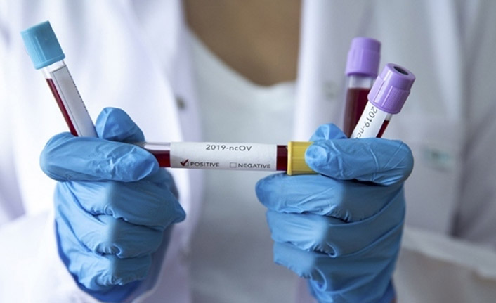 Kovid-19 nedeniyle ölenlerin sayısı dünya genelinde 50 bini aştı