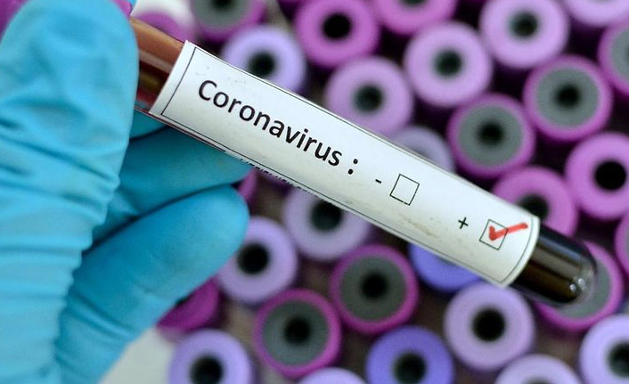 Bakan Koca Açıkladı! Testi pozitif çıktı