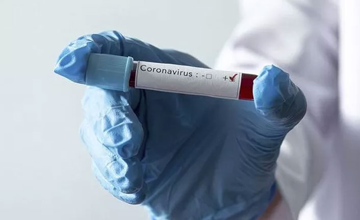 Koronavirüs aşısını bulduk diyen Rusya'dan flaş açıklama