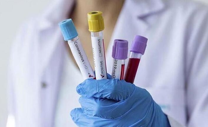 Dünya'da koronavirüs vaka sayısı artıyor