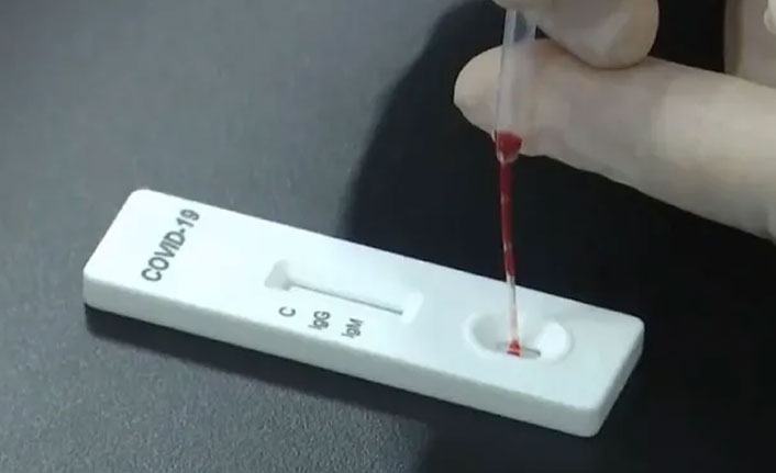 İngiltere'nin Çin'den ithal ettiği tanı kitlerinde koronavirüs çıktı!