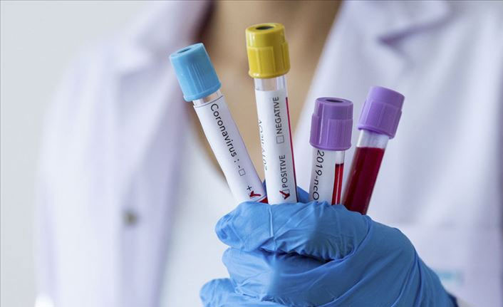 Japonya'da ölü sayısı 104 oldu