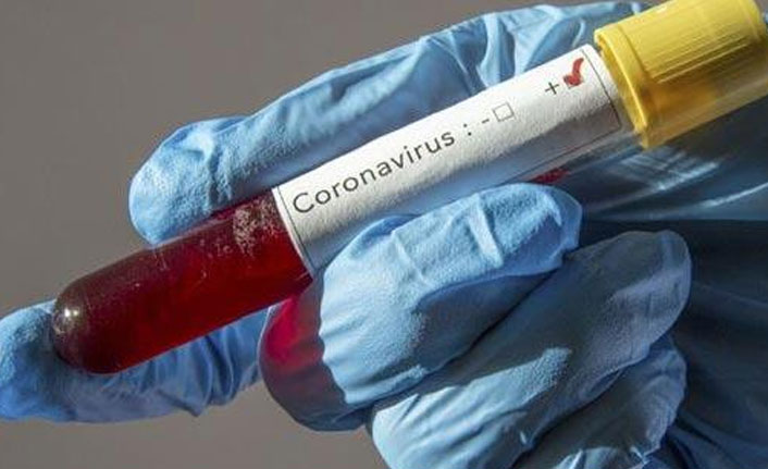 Arap ülkelerinde koronavirüs tablosu nasıl?