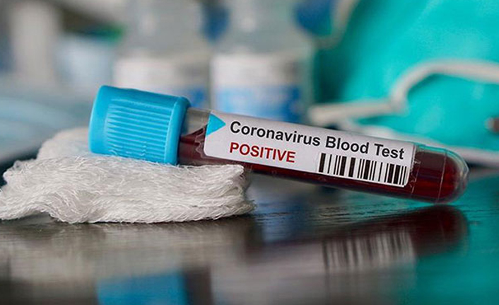 Almanya'da koronavirüsten ölenlerin sayısı arttı