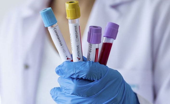 Trabzon'un koronavirüs raporu - 07.04.2020