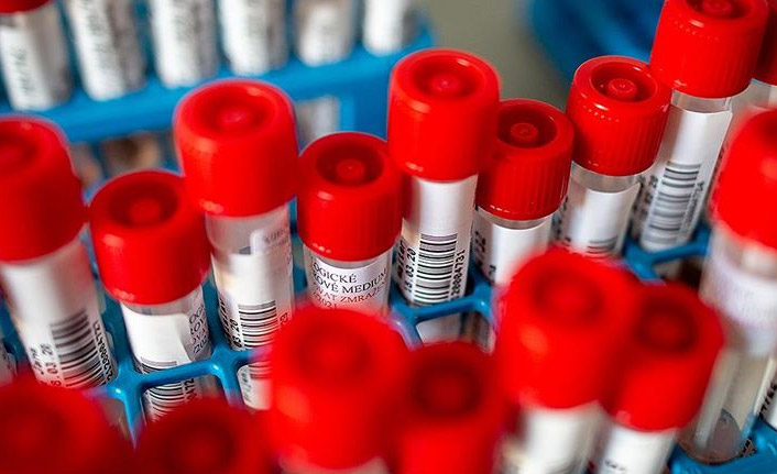 Sağlık Bakanlığı açıkladı! Koronavirüs izole edildi