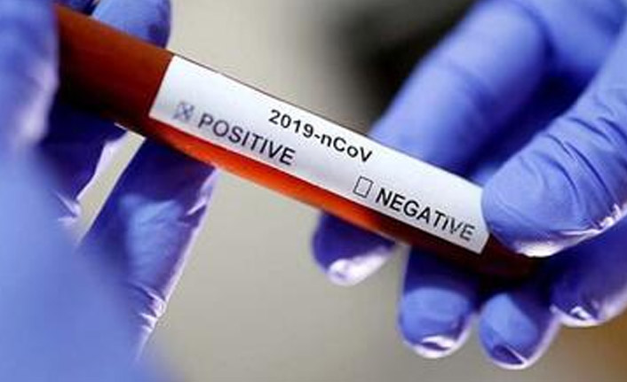 Trabzon’un koronavirüs raporu! İşte günün rakamları