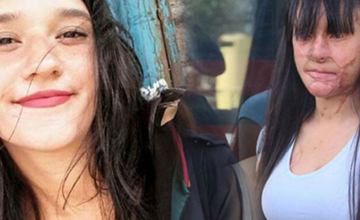 Kendisini asitle yakan eski erkek arkadaşını affetti!