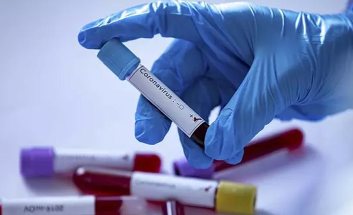 Dünyada koronavirüs vakaları 1 milyon 700 bini aştı