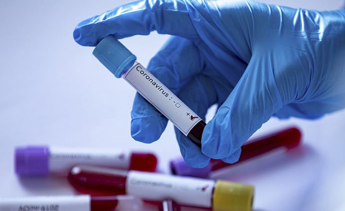 Koronavirüs sınır tanımıyor! Onlara da bulaştı