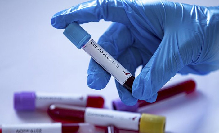 KTÜ'lü profesörden önemli açıklama! "Bulaşmaz"