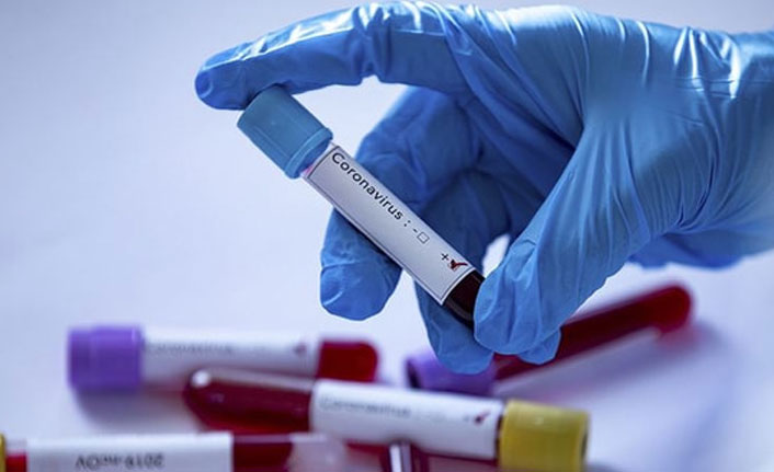 DSÖ sözcüsü: Türkiye'de yükseliş var