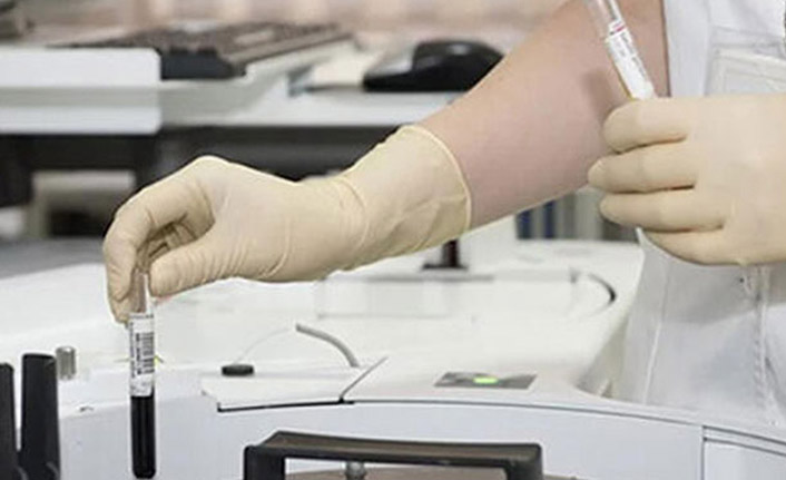 Sağlık Bakanı Koca duyurdu! Koronavirüste Filyasyon nedir?