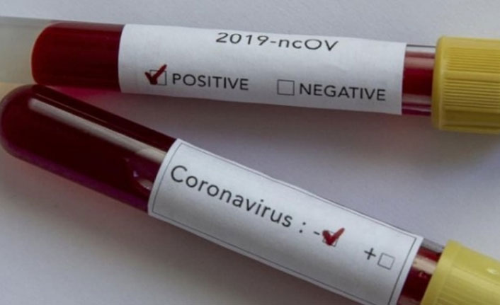 Malatya'da bir mahalle karantinaya alındı