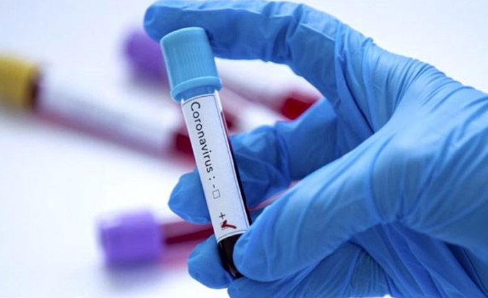 Koronavirüs ile ilgili kelimeler yerine Türkçe öneriler