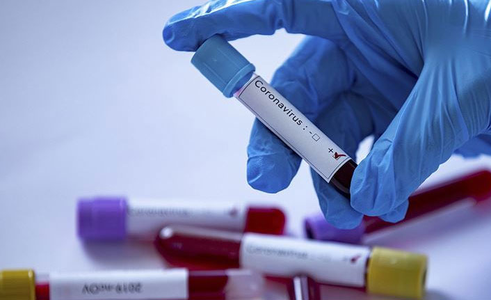 Türkiye’nin Günlük Koronavirüs Tablosu Açıklandı: 123 Can Kaybı