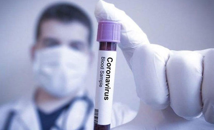 Koronavirüsten ölü sayısı 177 bin 688 oldu