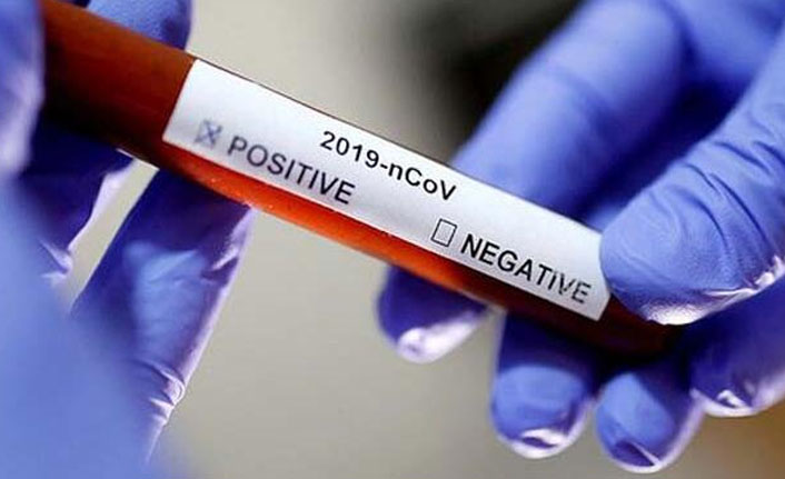 Yapay zeka ile korona virüs teşhisi