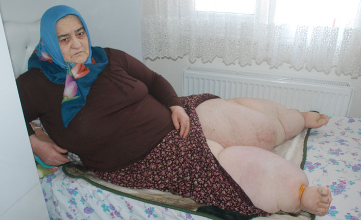 Trafik kazasından sonra bu hale geldi!