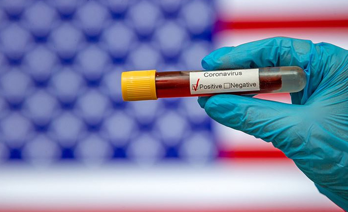 Kritik koronavirüs raporu! Saatlerce kalabiliyor