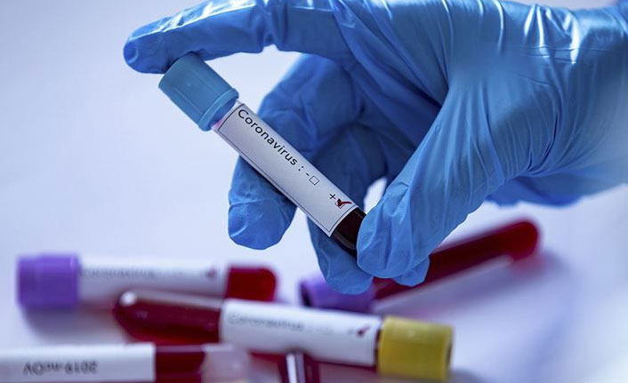 Koronavirüsün bulaşabileceği bir yol daha ortaya çıktı