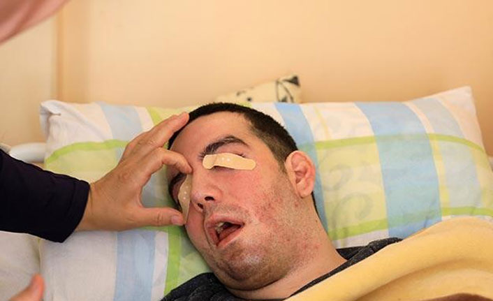 Yürek yakan olay! Gözlerini 6 yıldır yara bandıyla kapatıyor...