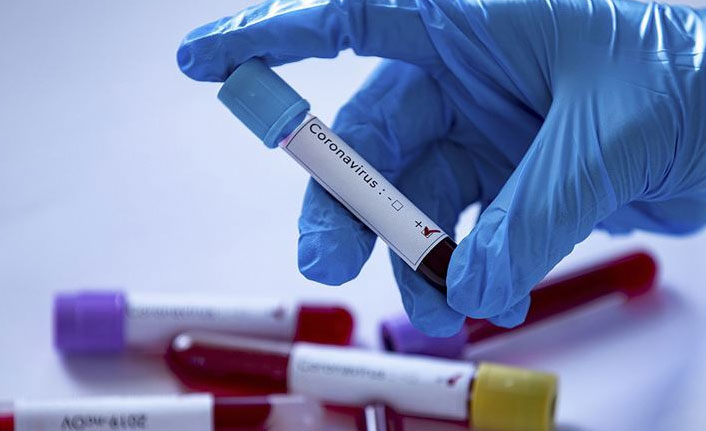 Koronavirüs ikinci kez bulaşır mı? Yapılan araştırma noktayı koydu