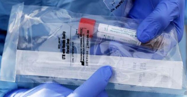 Almanya’da koronavirüsten ölenlerin sayısı 7 bin 549