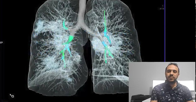 Türk yazılım mühendislerinden Kovid-19 tanı sistemi