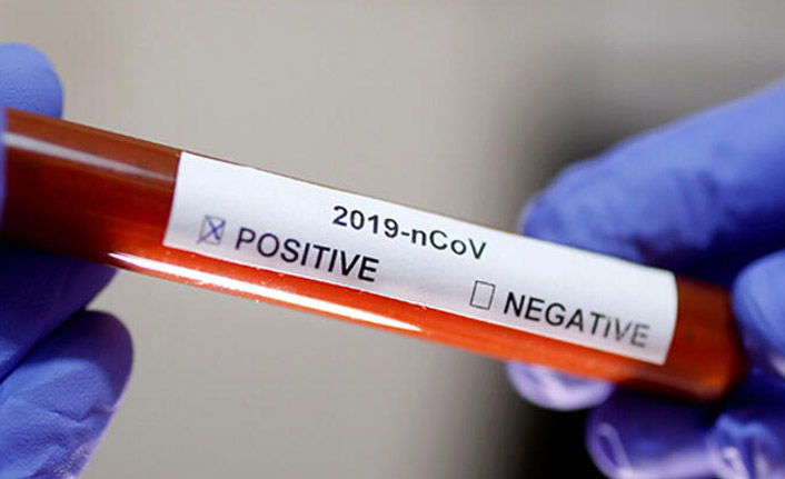 Trabzon’un koronavirüs raporu! İşte son durum