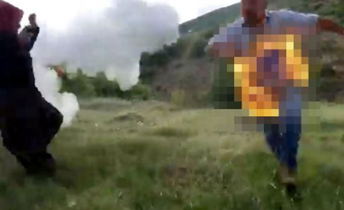 Teslim olmamak için kendini ateşe verdi!