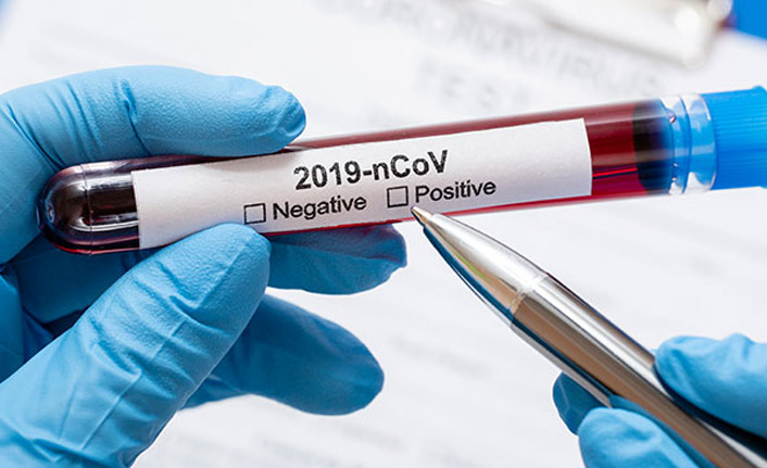 Dünya genelinde koronavirüs bilançosu