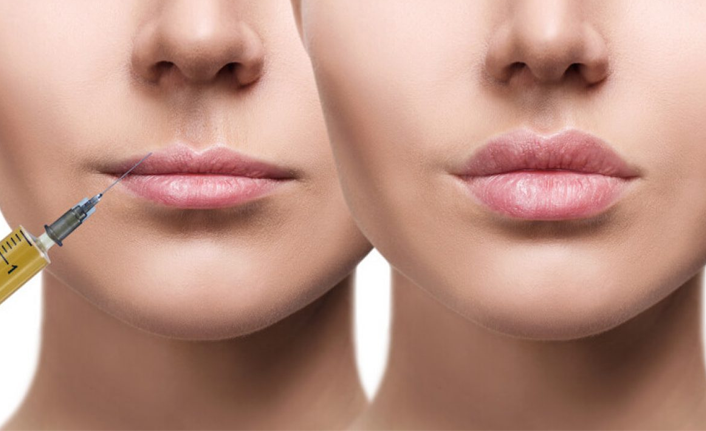 "Dudak dolgusunda memnuniyet oranı çok yüksek"