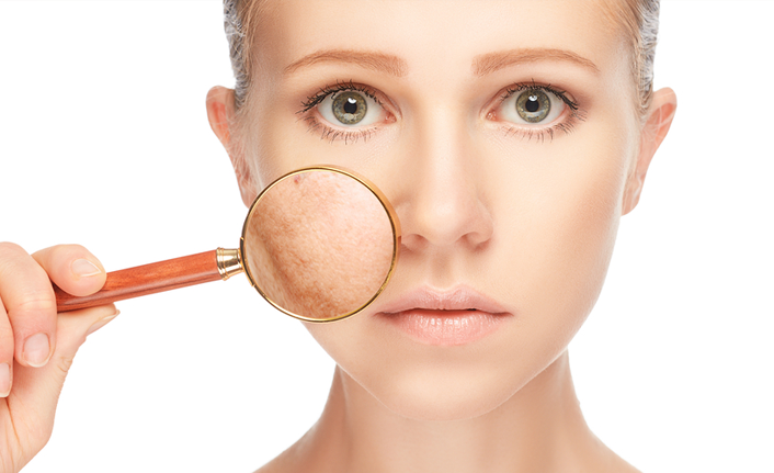 Güneşle gelen cilt lekelerine dikkat!