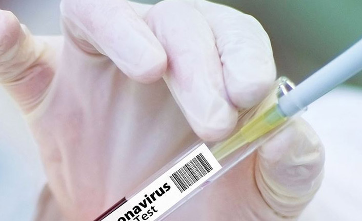 Kovid-19'a karşı yeni aşı adayının klinik denemelerine başlandı