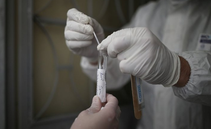 Hıçkırık koronavirüsün yeni belirtisi mi? 4 gün boyunca hıçkırdı...