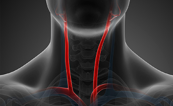 ''Unutkanlık, şah damarı darlığının belirtisi olabilir’’