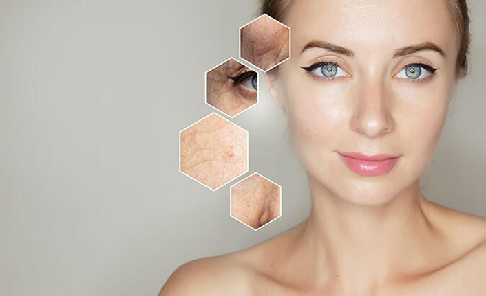 İşte stresin ciltte yol açtığı 6 hasar!