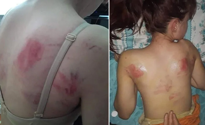 Kızını İngiliz anahtarıyla dövdü!