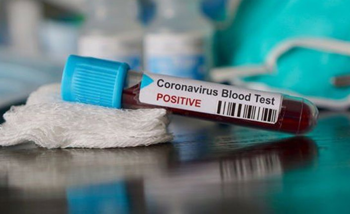 Koronavirüsle ilgili korkutan araştırma! Çocuklar haftalarca...