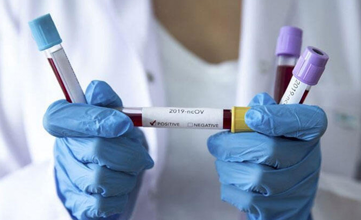 Virüs kapan yeni gelin, düğünlere katıldı köy karantinaya alındı