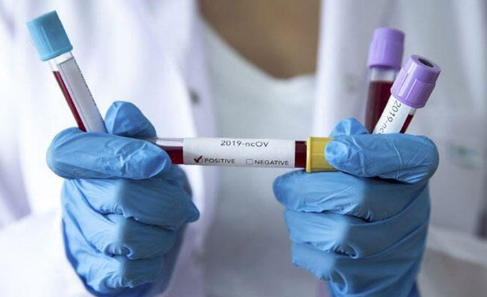 Uzman isimden endişelendiren öngörü! Koronavirüste ikinci dalga ne zaman gelecek?