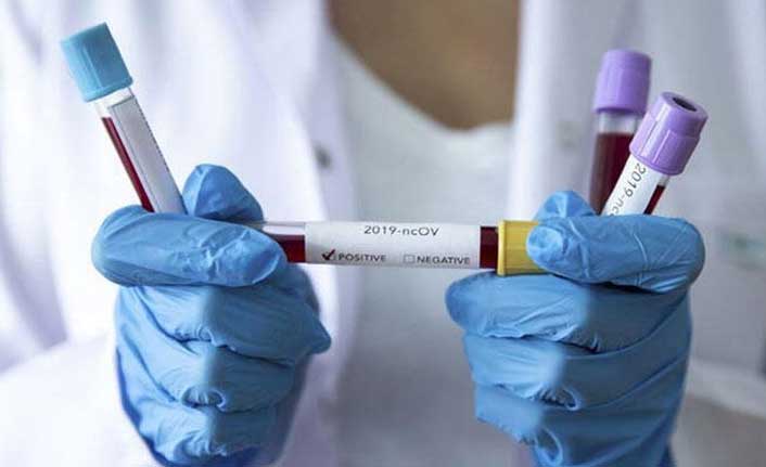 Kaymakam ve Belediye Başkanı koronavirüse yakalandı