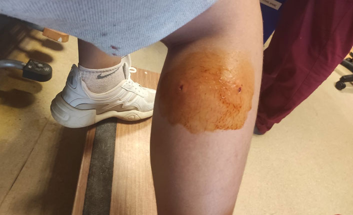 Başıboş köpekler genci hastanelik etti