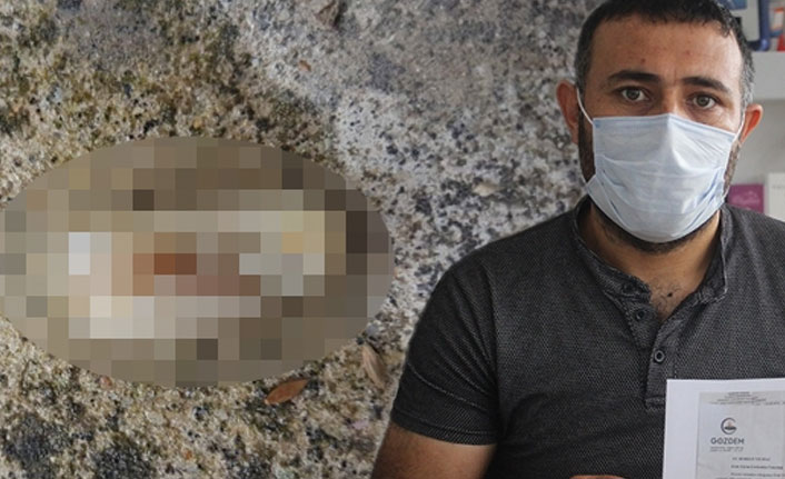 Kopan parmak işçinin yemeğinden çıktı