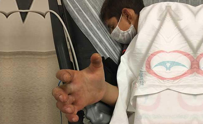 Yılanın ısırdığı çocuk yoğun bakımda