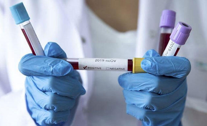 Koronavirüsle ilgili yeni araştırma: İyileşseler bile...