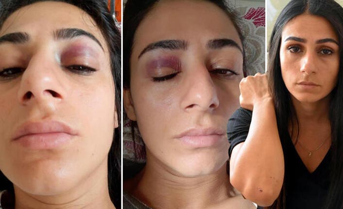 Sokak ortasında dehşet! Tacize karşı koyunca dövüldü...